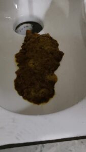 Free Scat Porn