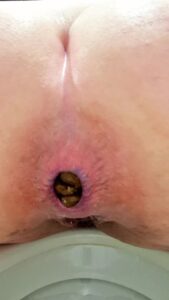 Free Scat Porn