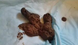 Free Scat Porn
