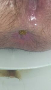 Free Scat Porn