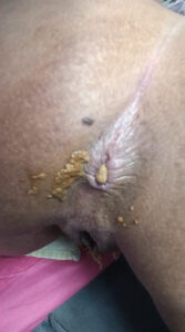 Free Scat Porn