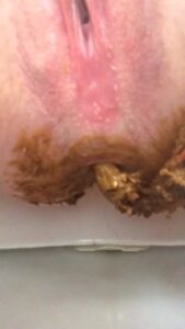 Free Scat Porn