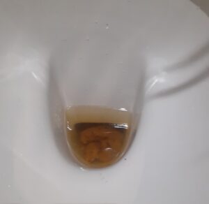 Free Scat Porn