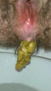 Free Scat Porn