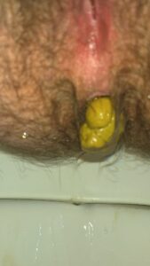 Free Scat Porn