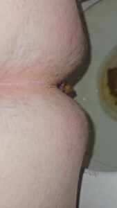 Free Scat Porn