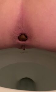 Free Scat Porn