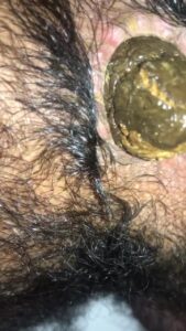 Free Scat Porn
