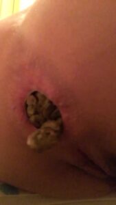 Free Scat Porn