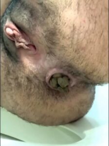 Free Scat Porn