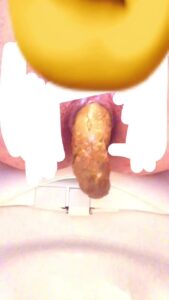 Free Scat Porn