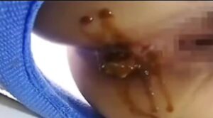 Free Scat Porn
