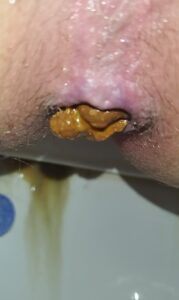 Free Scat Porn