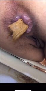 Free Scat Porn