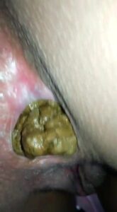 Free Scat Porn
