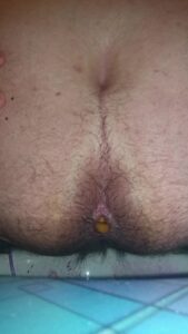 Free Scat Porn