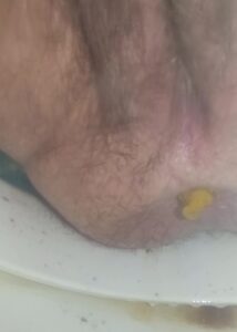 Free Scat Porn