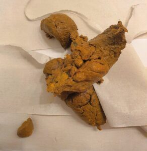 Free Scat Porn