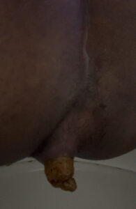Free Scat Porn
