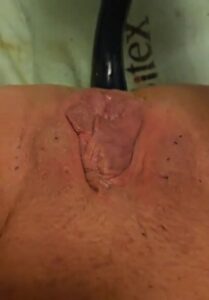 Free Scat Porn