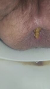 Free Scat Porn