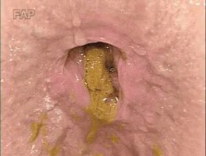 Free Scat Porn