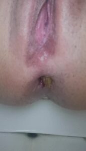 Free Scat Porn