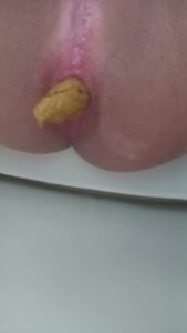 Free Scat Porn