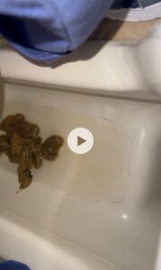 Free Scat Porn