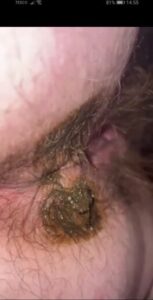 Free Scat Porn