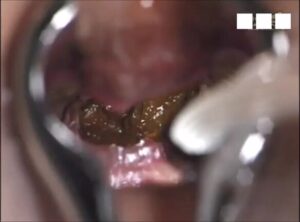 Free Scat Porn