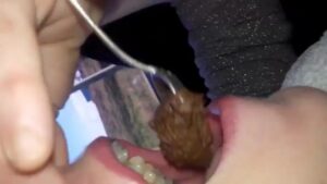 Free Scat Porn