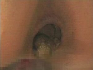 Free Scat Porn