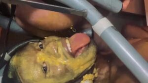 Free Scat Porn