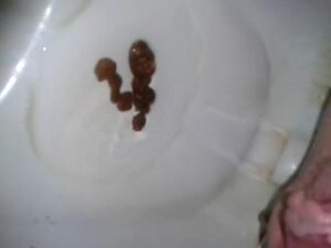 Free Scat Porn