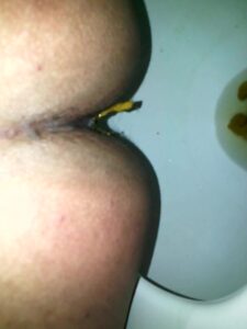 Free Scat Porn