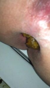 Free Scat Porn