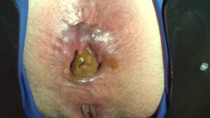 Free Scat Porn