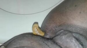 Free Scat Porn