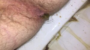 Free Scat Porn