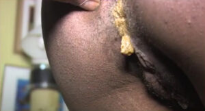 Free Scat Porn