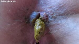 Free Scat Porn