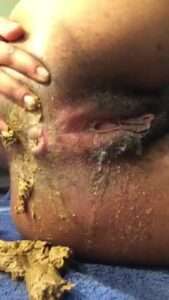 Free Scat Porn