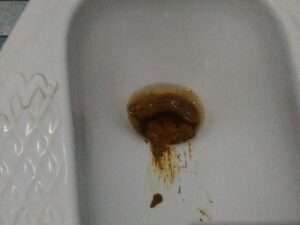 Free Scat Porn